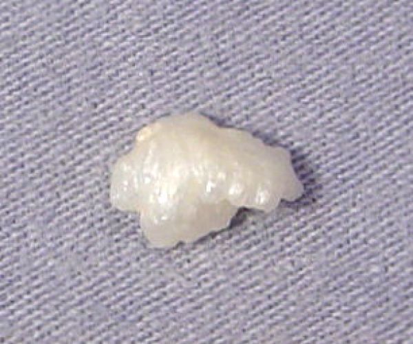 Antique natural pearl